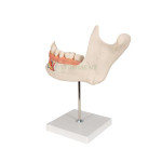 Human Teeth Model, Lower Jaw, on Stand